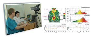Тепловизионные медицинские комплексы NEC